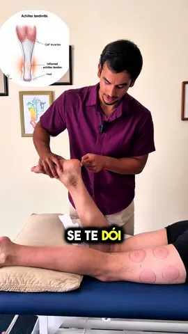 Dói-te o pé ou a zona do tornozelo?  Dependendo da localização, a causa pode ser bem diferente: ✅ Tendinopatia do tendão de Aquiles – dor atrás do tornozelo, mais comum em quem corre ou salta. ✅ Bursite retrocalcaneana – dor mesmo atrás do calcanhar, associada a inflamação da bursa. ✅ Disfunção do tibial posterior – dor e desconforto na parte interna do tornozelo. ✅ Fascite plantar – dor na planta do pé, sobretudo no primeiro passo da manhã. ✅ Neuroma de Morton – dor ou sensação de “pedrinha no sapato” entre os dedos do pé. 👉 Saber identificar a origem da dor é o primeiro passo para o tratamento certo. Se tens alguma tendinopatia a suplementação de Colagenio da prozis é um excelente complemento para a tua reabilitação. Usa o código TomasFisio para -10% e oferta de produtos.  #pe #tornozelo #fisioterapia #osteopatia 