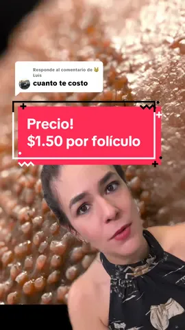 Respuesta a @😼Luis #greenscreen ✨ El precio de tu trasplante capilar siempre es $1.50 por folículo en nuestra clínica ✨ 👉 El costo final depende de la cantidad de folículos que necesites, por eso realizamos una evaluación personalizada para cada paciente. 📲 Escríbenos para agendar tu consulta y dar el primer paso hacia tu nuevo look. #HairTransplant #TrasplanteCapilar #MiamiHair #HairRestoration 