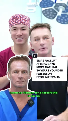 SMAS FACELIFT AFTER 6 DAYS - MORE NATURAL - 30 YEARS YOUNGER FOR JASON FROM AUSTRALIA #facelift #facelifting #xuhuong #xuhuongtiktok #australia 