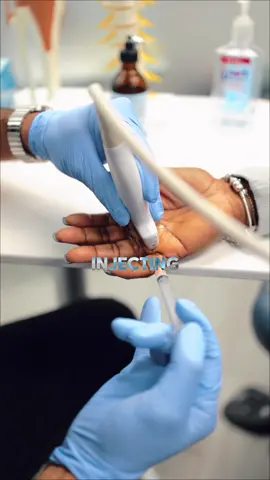 How to relieve pain from arthritis? Steroid injections in the hand can calm inflammation that causes pain and stiffness. They’re often used for carpal tunnel or trigger finger, helping reduce swelling so the hand can move more freely. #arthritis #painrelief #painmanagement 