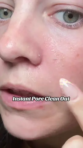 This was a top 5 tiktok shop find 🤩 #drmelaxin #peelshot #porecleanser #skincare #dryskin 