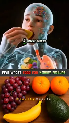 Five worst fruits for kidney failure  #healthcare #healthy #fruits #kidney #kidneyfailure 