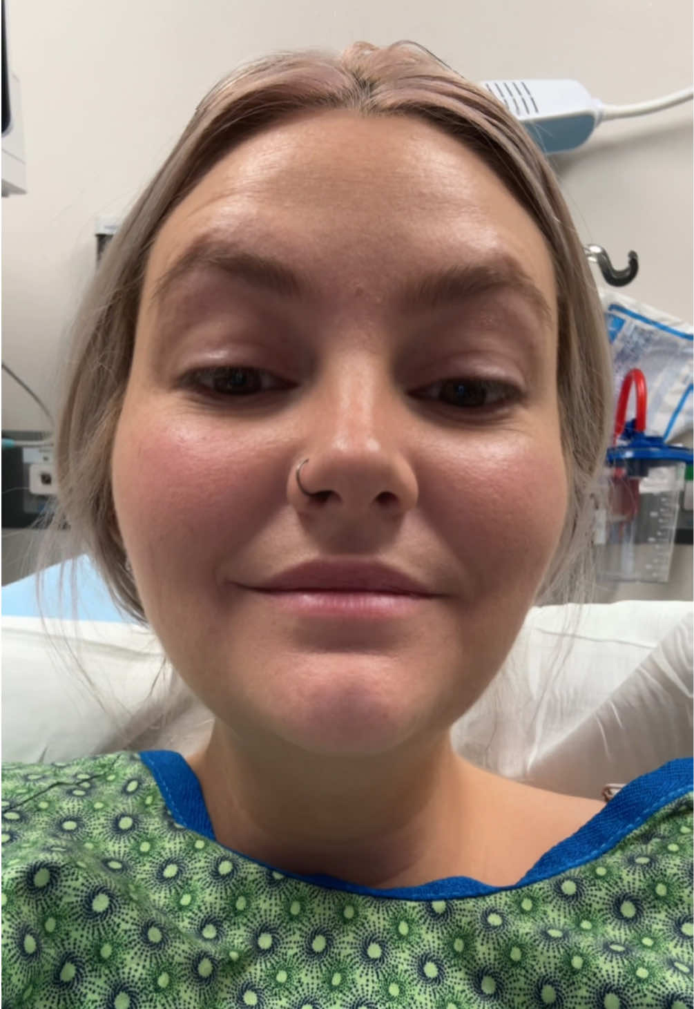 The Dr said the skin is dying or already dead, I can’t really remember… so it is an emergency 😅😅😅😅 #emergency #spiderbite #chatgpt #viral #fy 