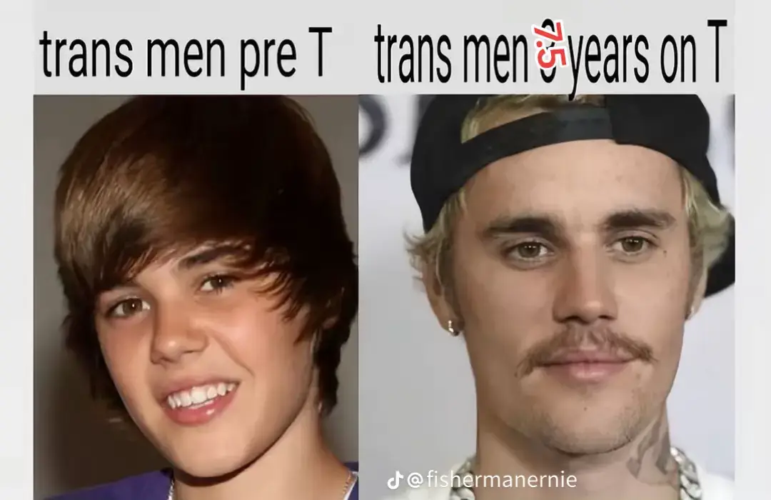 #ftm #hehimhis #testosterone 