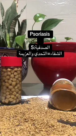 #plantemedicinale🍀 #مغرب_جزائر_تونس_خاوة🇩🇿🇲🇦🇹🇳 #وصفات_طبيعية #وصفات #plantemedicinale🌱  علاج الصدفية بالتحدي والتغذية الصحيحة اكيد ممكن