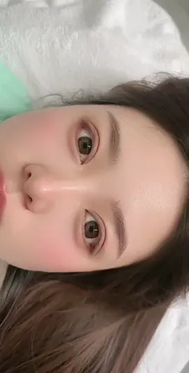 #全切雙眼皮#無痕雙眼皮#眼修復#眼瞼下垂#腫眼泡#去眼袋