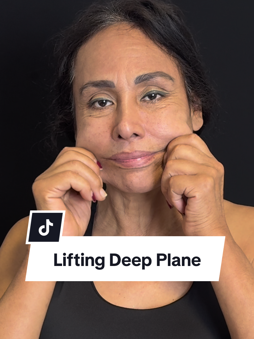 Nancy buscaba un resultado natural, no un rostro diferente. 👨🏻‍⚕️ Con el Dr. Freddy Castillo aplicamos: 🔹 Lifting Deep Plane → reposiciona tejidos en profundidad para rejuvenecer de forma armónica 🔹 Submentoplastia → define el ángulo cervicofacial 🔹 Lipoinjerto → recupera volumen en zonas clave del rostro 💠 Resultado: un rostro más fresco, definido y natural. 📲 Agenda tu valoración personalizada y descubre qué tratamiento es ideal para ti. Escríbenos a DM/WhatsApp al +51 967 310 393. #LiftingFacial ✨ #DeepPlane #ArmonizaciónFacial 💠 #ResultadosNaturales #EstéticaLima  📸      🔥