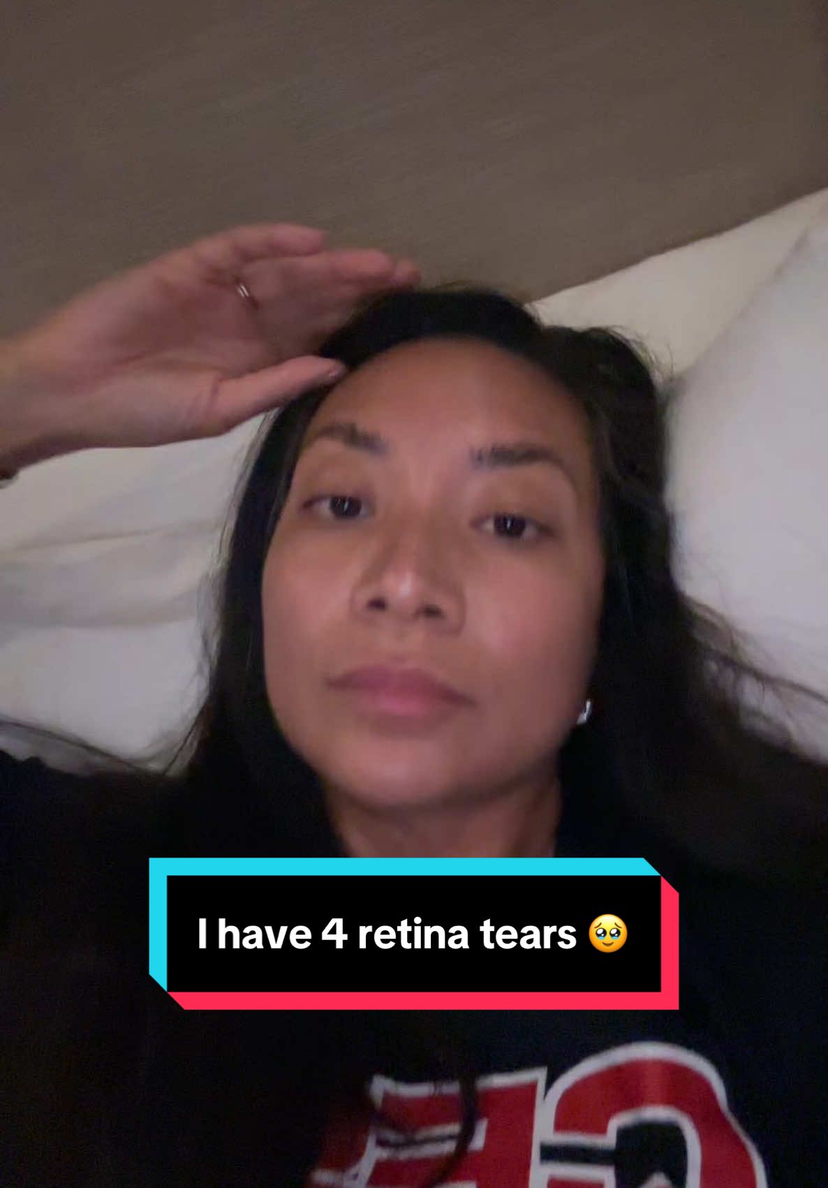 I’ve had 4 retina tears in the span of 3.5 weeks 🥹 has this happened to anyone else? I did ICL eye surgery in May then this started to happen the beginning of August. Please let me know!! 😞 #icleyesurgery #retinatear #retinateareyesurgery #emergencyeyesurgery #eyesurgery 