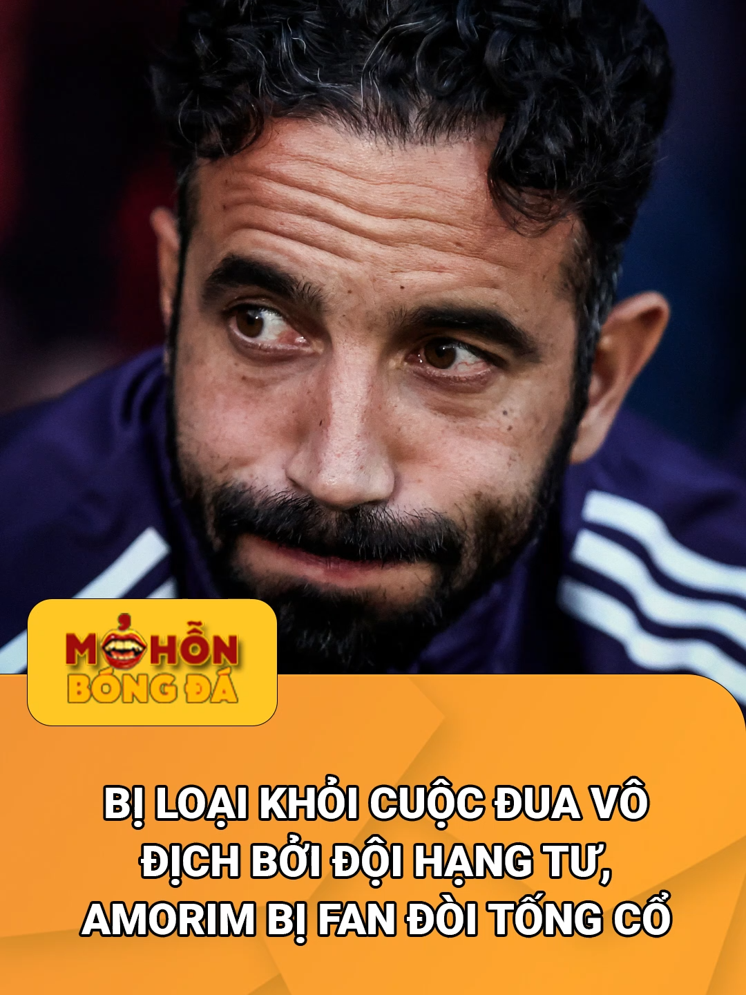 Trình này mà đòi đua vô địch Premier League #bongda #manchesterunited