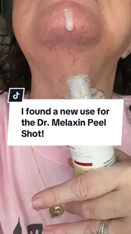 This actually is a GAME CHANGER! 😢 #creatorsearchinsights vira skincare products #viralskincareproducts #peelshot #exfoliator #chinhair 