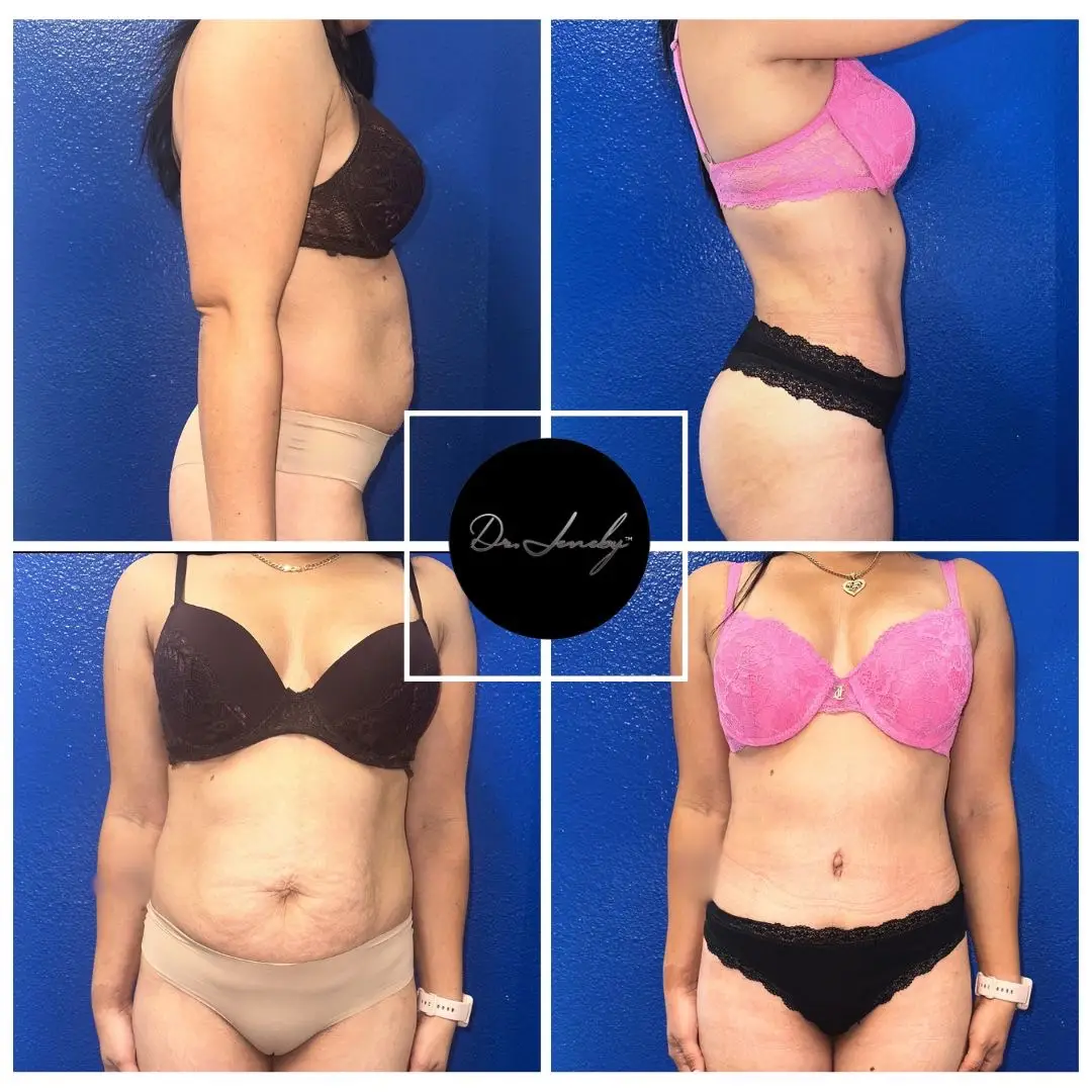 🌟 Check out this incredible before and after! 🌟  Did you know we offer a laser treatment for hair loss? If you’re curious about how it works, give us a call to schedule a free virtual consultation with one of our expert providers. Let’s get you on the path to fuller, healthier hair! 💖✨