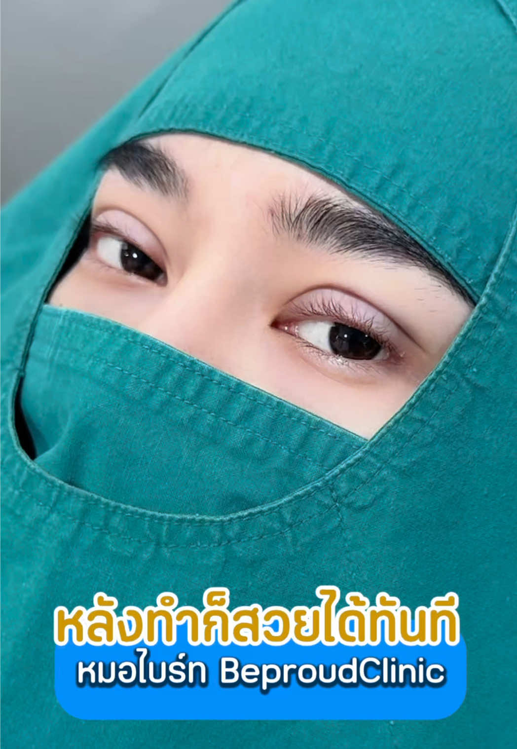 หลังทำก็สวยได้ทันที 🥰 #ศัลยกรรมตา2ชั้น #ทําตาสองชั้น #บีพราวด์คลินิก #fyp #tiktokviral @หมอไบร์ท บีพราวด์ 