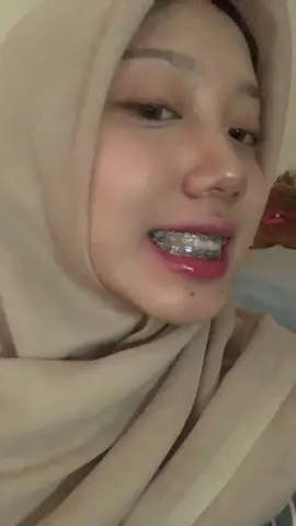 2yrs braces. (warna abu” oks sama-sama) 