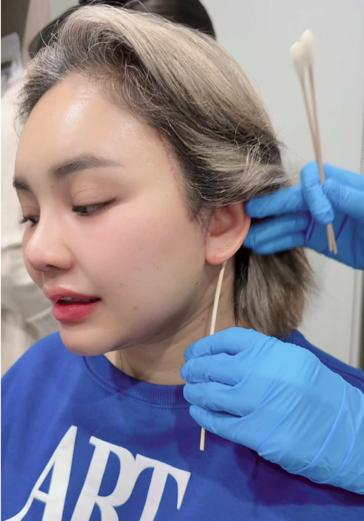 พี่ๆพยาบาลล้างแผลให้ บอกว่าแผลดีมากกกก @W_Hospital #ตั้กแตนชลดา #ตั๊กแตน #เพลงดังtiktok #เพลงฮิตtiktok 