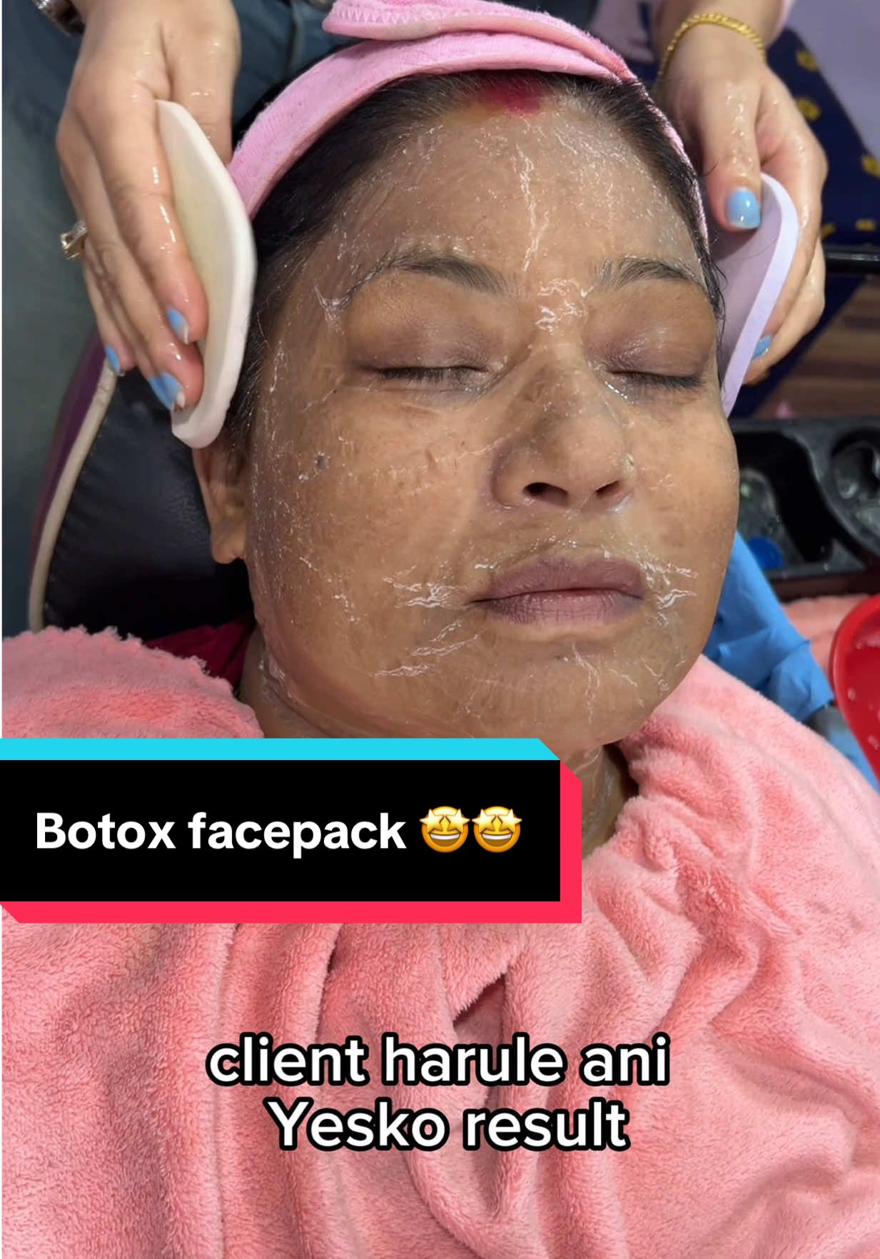 ✨ Revive Botox Facepack ✨ The ultimate wrinkle treatment — trusted for both professional use & personal care 🌸💆‍♀️ . . . #wrinkles #wrinkletreatment #antiaging #finelines #skintreatment 