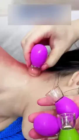 Barang impor. Alat bekam pijat ini sangat berguna. Direkomendasikan. Ayo beli sekarang.