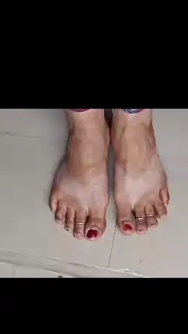 white feet at home low cost remides #fypシ #foryou #removerdeadskin 