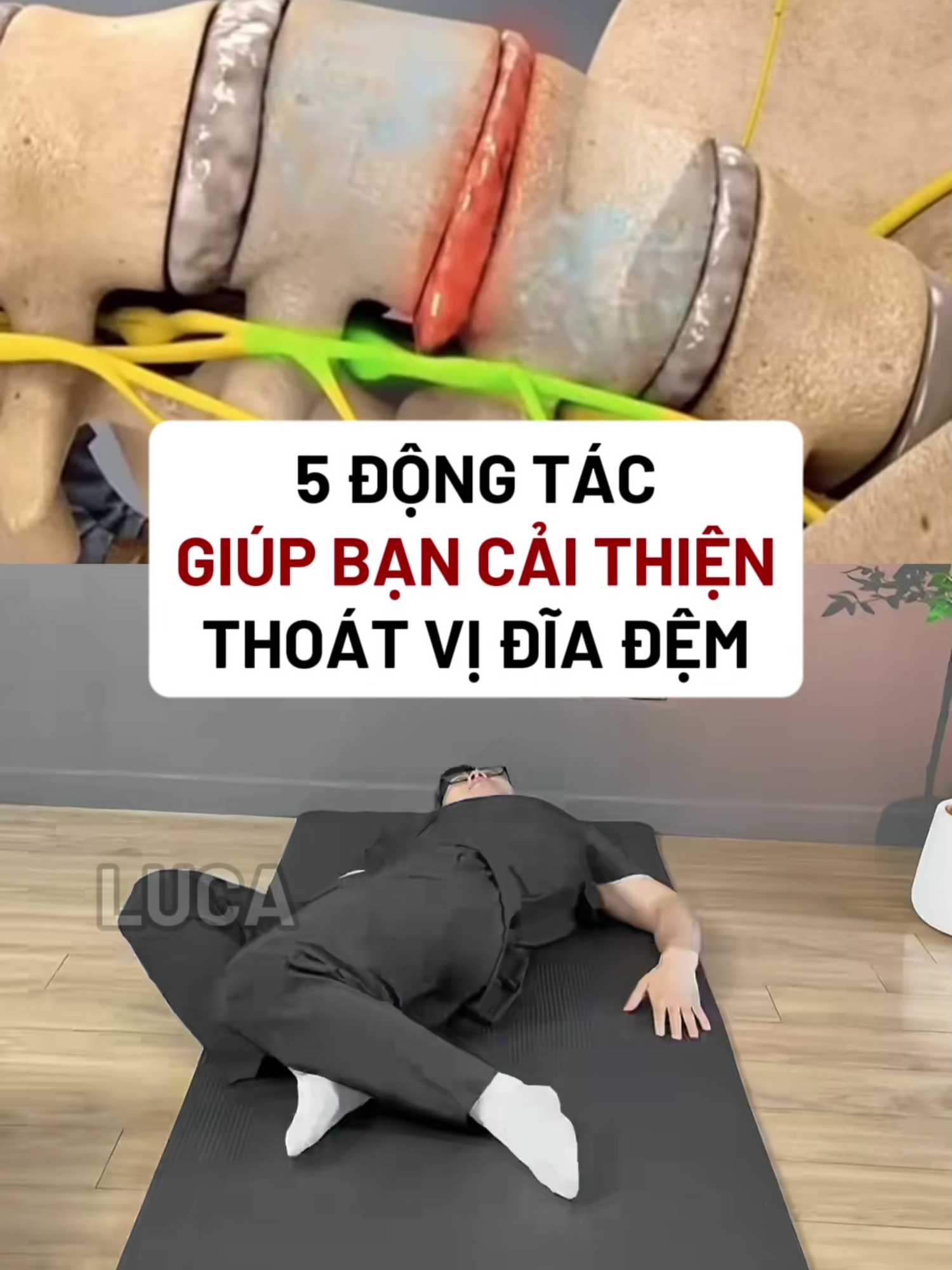 5 ĐỘNG TÁC GIÚP BẠN CẢI THIỆN THOÁT VỊ ĐĨA ĐỆM #Luca #virals #xuhuong #baitap