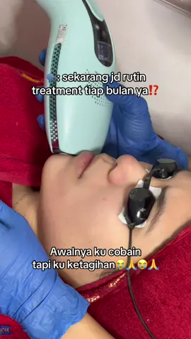 Ada ga sih disini yang belum pernah treatment sama sekali?? Yuk Treatment di Kezia Facial Spot, yakin deh gaakan bikin kantong boncos🤩✨ Booking sekarang juga dan rasakan hasilnya✨: 📞: +62 811-2447-334 📍: Jl. Karawitan No 27 Bandung #treatment #semuabisaglowing #ipltreatment #keziafacialspot #treatmentwajah 