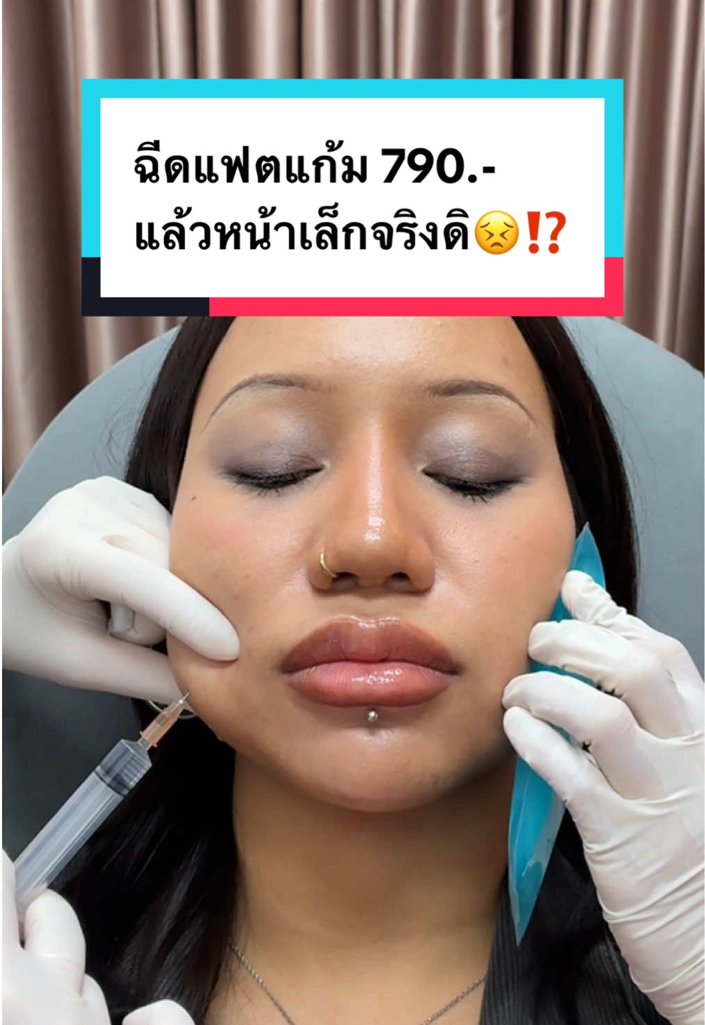 ฉีดแฟตแก้ม 790.- หน้าเล็กจริงมั้ย⁉️ #AuraXpress #แฟต #แฟตแก้ม #ฉีดแฟต #หน้าเรียว 