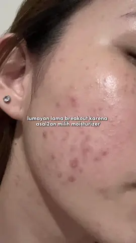 gonta-ganti moisturizer ternyata cocok nya sama moist 40ribuan😵‍💫🥰 #moisturizer #moistviral #glad2glow
