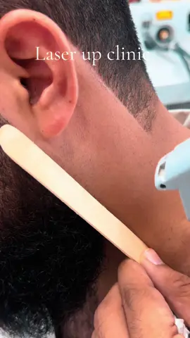 #laserupclinic #peshawarbestclinic #kamranclinic #hairremoval #tiktokteamunfreezmyacount😥🙏 
