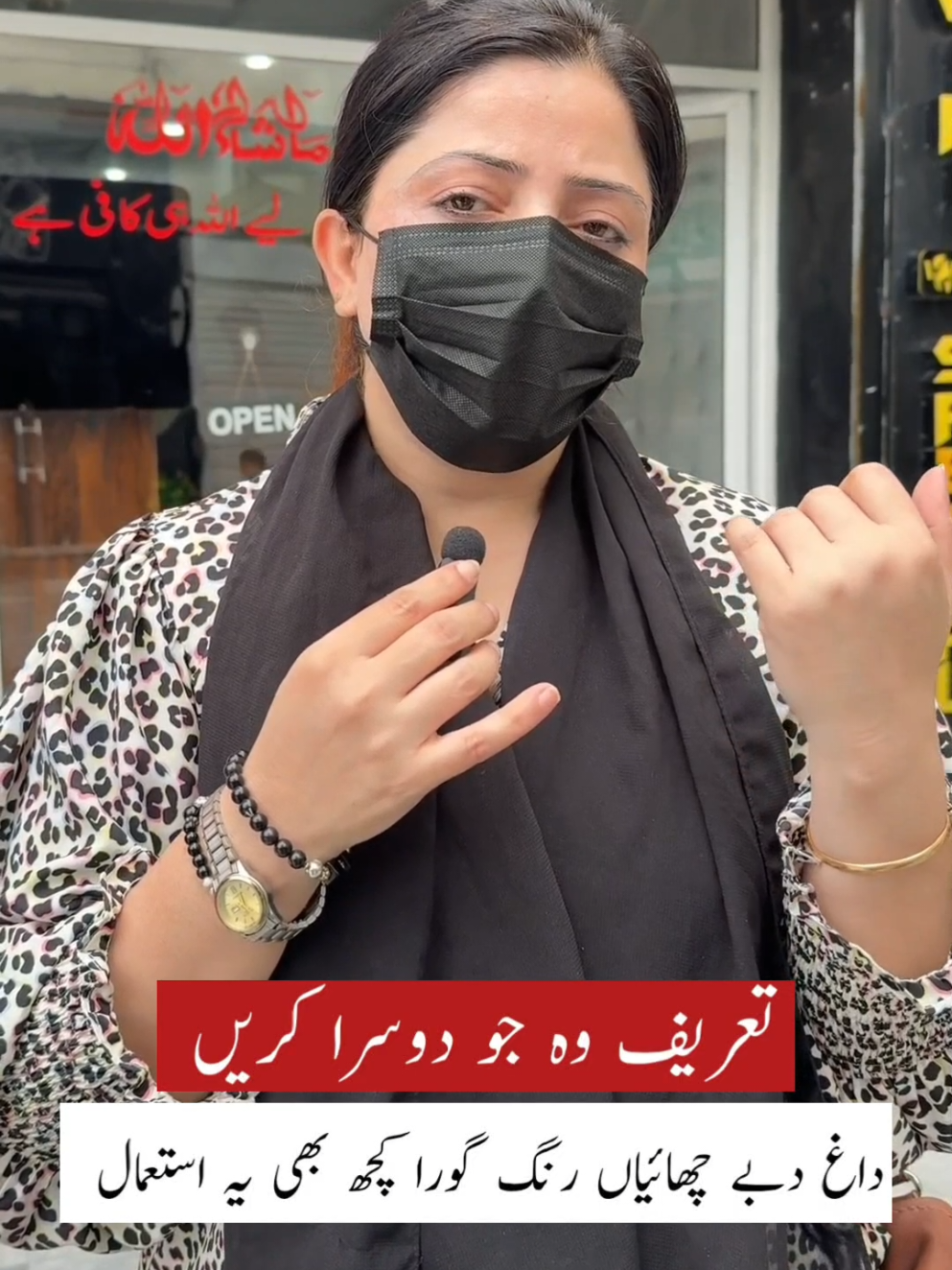 داغ دھبے چھائیاں رنگ گوڑا کچھ بھی  #foryou #foryoupage❤️❤️ #wikispecialofficial #wikispecialdaska 