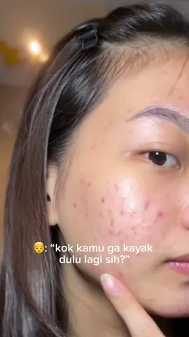 Must have sih #retinolviral #retinolserum #retinoid #retinol #retinoid 