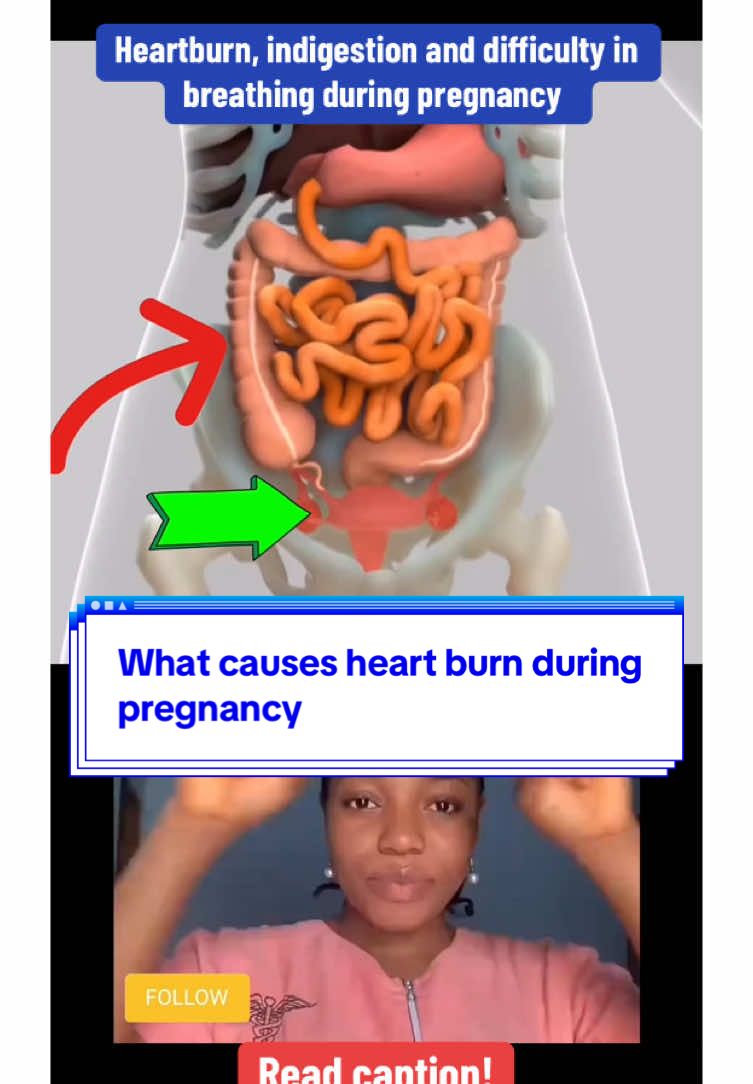 What causes heartburn, indigestion and breathing difficulties during pregnancy ?  The internal changes your body experiences during pregnancy are incredible, so much moving and shifting happens to make room for your growing baby, causing heartburn, indigestion and breathing difficulties and other uncomfortable symptoms during pregnancy 🤰 #nurseug #relatable #pregnancytiktok #pregnancypelvicexercises #viralvideos #pregnancyjourney #goviral #fypシ゚ 