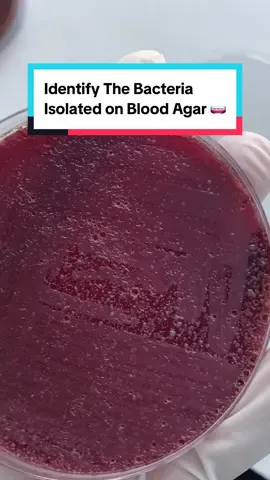 Blood agar is a nutrient-rich culture medium commonly used in microbiology to grow fastidious organisms and to differentiate bacteria based on their hemolytic properties. It consists of a base, usually tryptic soy agar or nutrient agar, supplemented with about 5% sheep, horse, or human blood. Blood agar not only supports the growth of a wide range of microorganisms but also allows observation of hemolysis, the breakdown of red blood cells by bacterial enzymes. Depending on the type of hemolysis, colonies may produce clear zones around them (β-hemolysis), greenish discoloration (α-hemolysis), or no visible change (γ-hemolysis). This makes blood agar an essential tool in clinical diagnostics for identifying pathogens such as Streptococcus species and other clinically important bacteria. #tiktokzambia🇿🇲 #foryoupage 