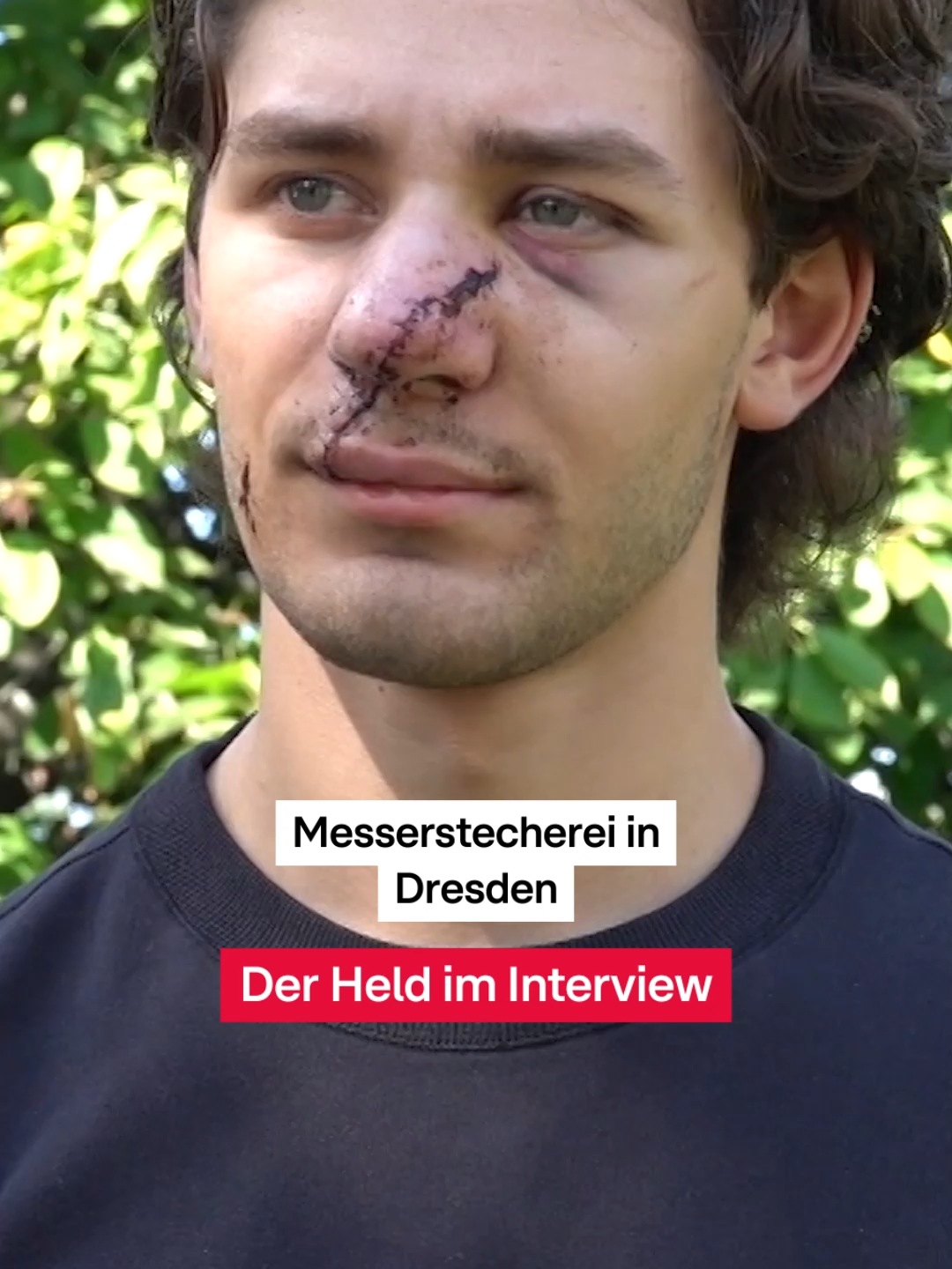 John Rudat zeigt Zivilcourage und geht dazwischen, als 2 Männer am Wochenende (24.08.) in #Dresden eine Frau angreifen. Wie er es selbst erlebt hat, seht ihr im Video. #Redaktion #RTLAktuell #zivilcourage