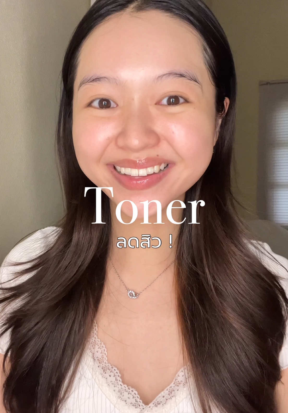 Toner ที่ช่วยเรื่องสิว สิวยุบไวมากๆ อันนี้เราใช้มาสักพักเเล้วแบบดีเฉยเลย คือปกติชอบใช้ Toner Padมาก แต่สิวบุกเลยลองใช้ Toner ของ BK แล้วดีมากก #รีวิวบิวตี้ #skincare #skincareroutine #รักษาสิว #skincaretips 