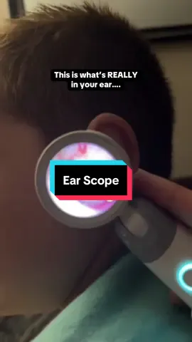 You’ll never look at your ears in the same way after this gross but so useful #EarInfection #Mom# #Earwax #YourCamera #TikTokShopLaborDaySale 