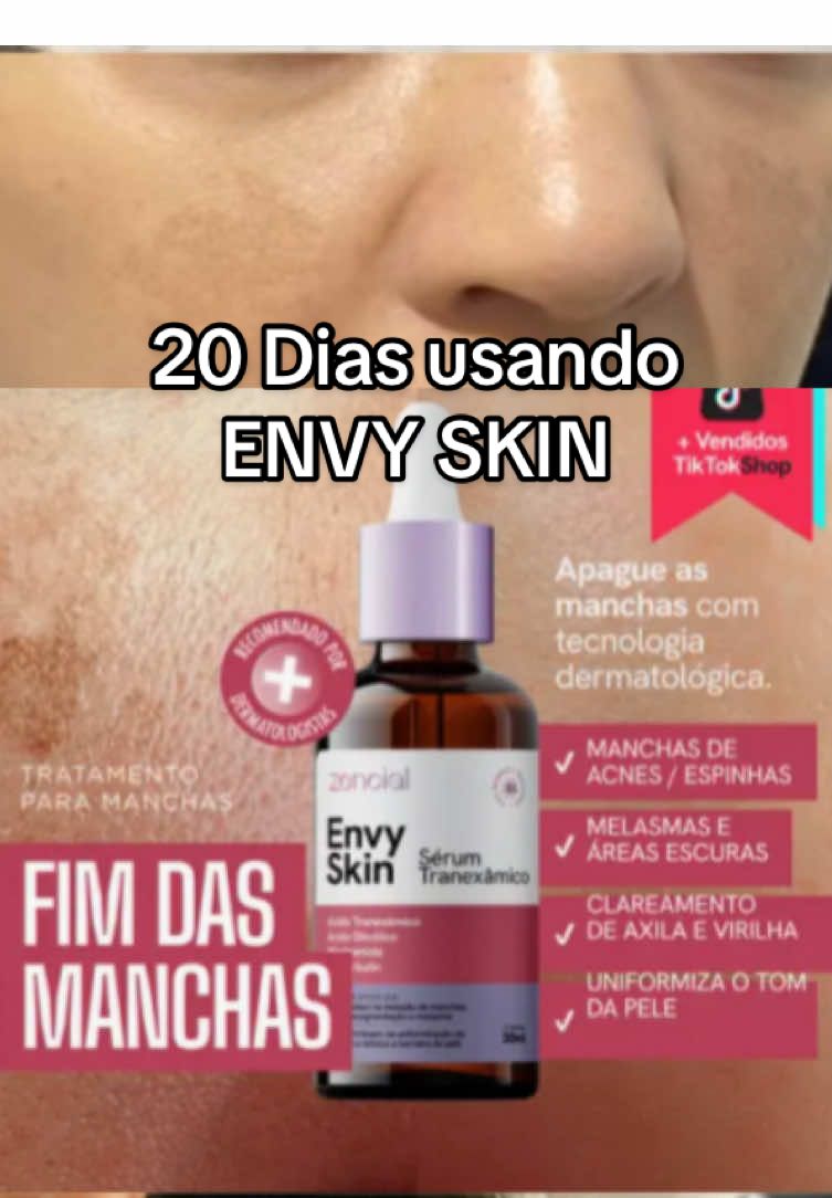 20 dias usando ENVY SKIN da #Zencial e minha amiga me disse isso.  #resultado #melasma #manchasdepele 