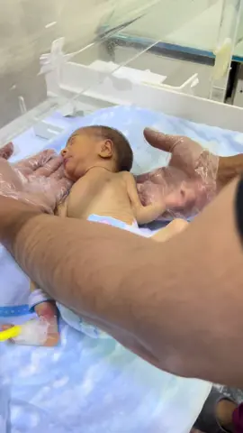 A hugeness fightar baby in our little and cute journey improved growth and wait#pleasetiktokteamviralvideo💯#3ilonvwes#unfrezzme#virolvedio#nicujourney