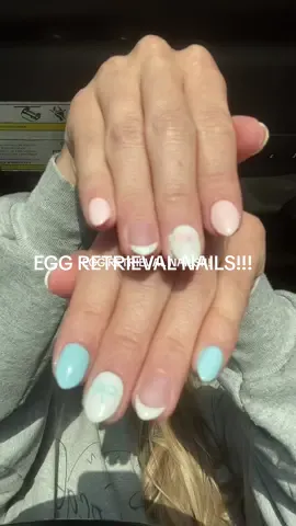 Egg retrieval nails!!!! #eggretrieval #ivf #ivfjourney 