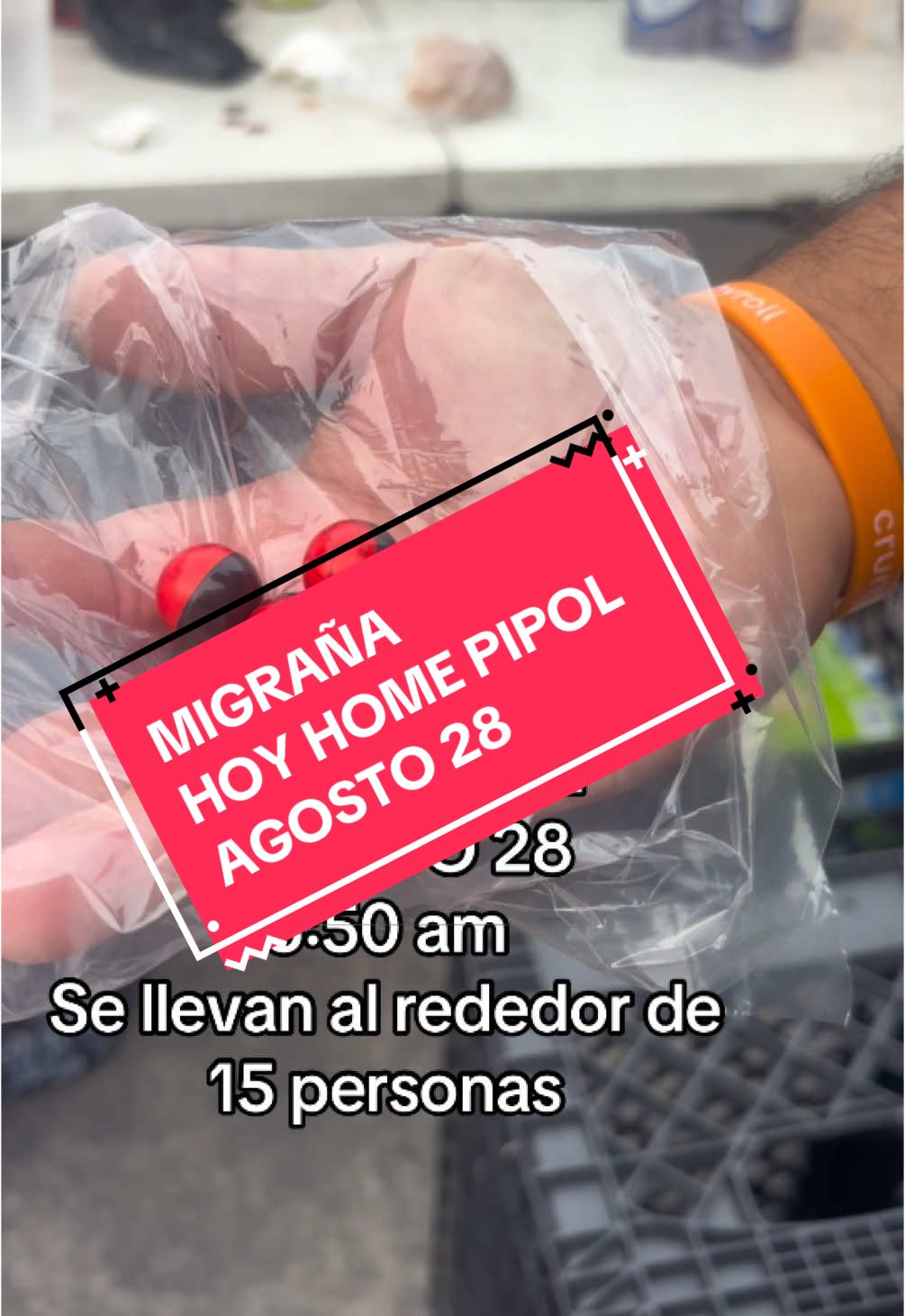 #fyp #dianalu #migrana 