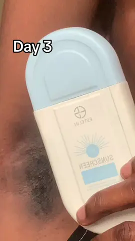 Fade hyperpigmentation in 3 days with ESTELIN Sunscreen ✨💫 This is magic !#SECRETGlowChallenge #hyperpigmentationtreatment #Seoul1988 #Retinal @KSECRET GLOBAL#PigmentationCare