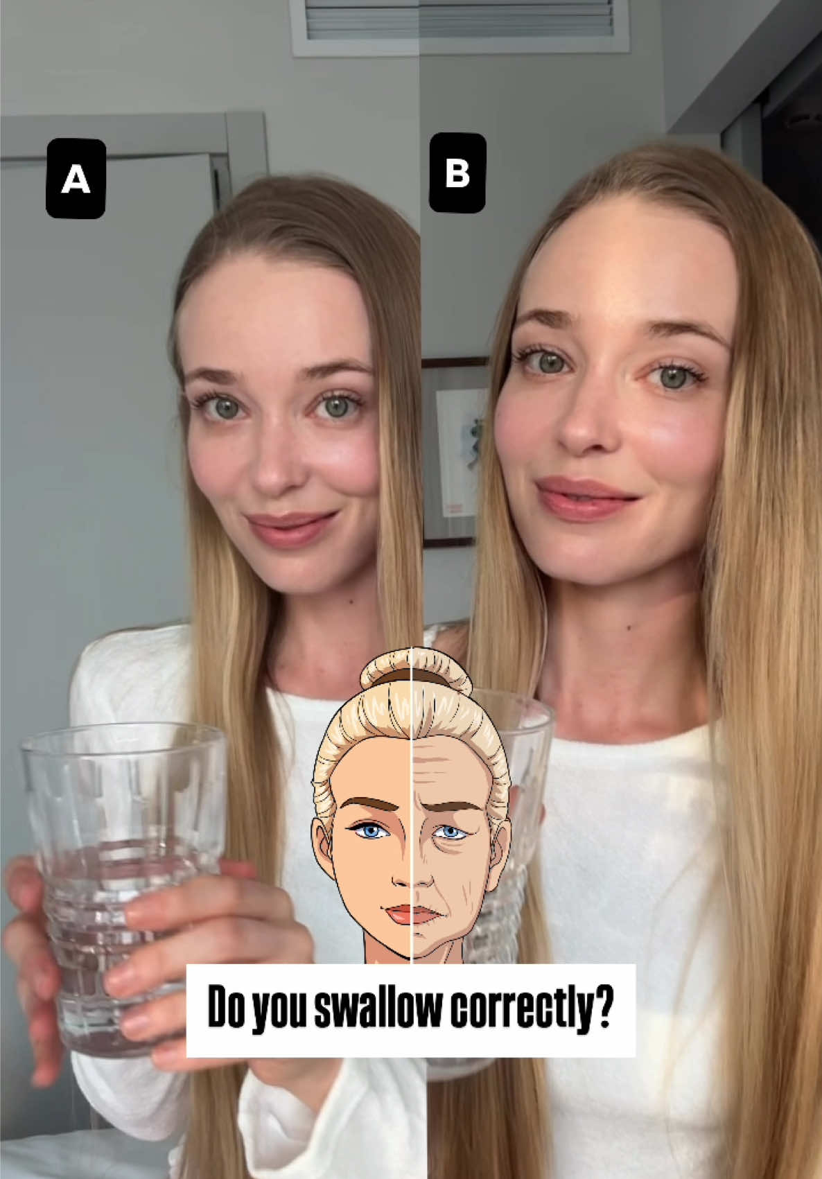 Good swallowing vs. bad swallowing 👇 Our face and neck follow one universal law: function shapes form, and form shapes function. The underjaw is like a diaphragm - it’s meant to move.  But if our function didn’t develop properly (for example, with bottle feeding or other jaw compensations early on), we often swallow with our lips, cheeks, and even chin.  That creates over-contraction in the wrong places and tension that drags the face down. In Option A (good swallowing), your underjaw and neck engage gently, while lips and cheeks support but don’t overwork. In Option B (bad swallowing), you see big contractions in the lips, cheeks, and chin - a pattern that creates lines, heaviness, and even long-term changes in jaw structure. 👉 Try it in front of a mirror: practice engaging your underjaw and neck, while letting the lips and cheeks relax.  Over time, your tissue learns a new pattern - lighter, lifted, and healthier. Would you like me to post a step-by-step swallowing awareness routine to train this daily? 👇 P.S.: head forward position is another factor that contributes to this. Inside GLOW we have a big focus on improving that. btw enrollment to GLOW is closing as we speak, so this is your last chance to join. If by the time you click on the link and it says 