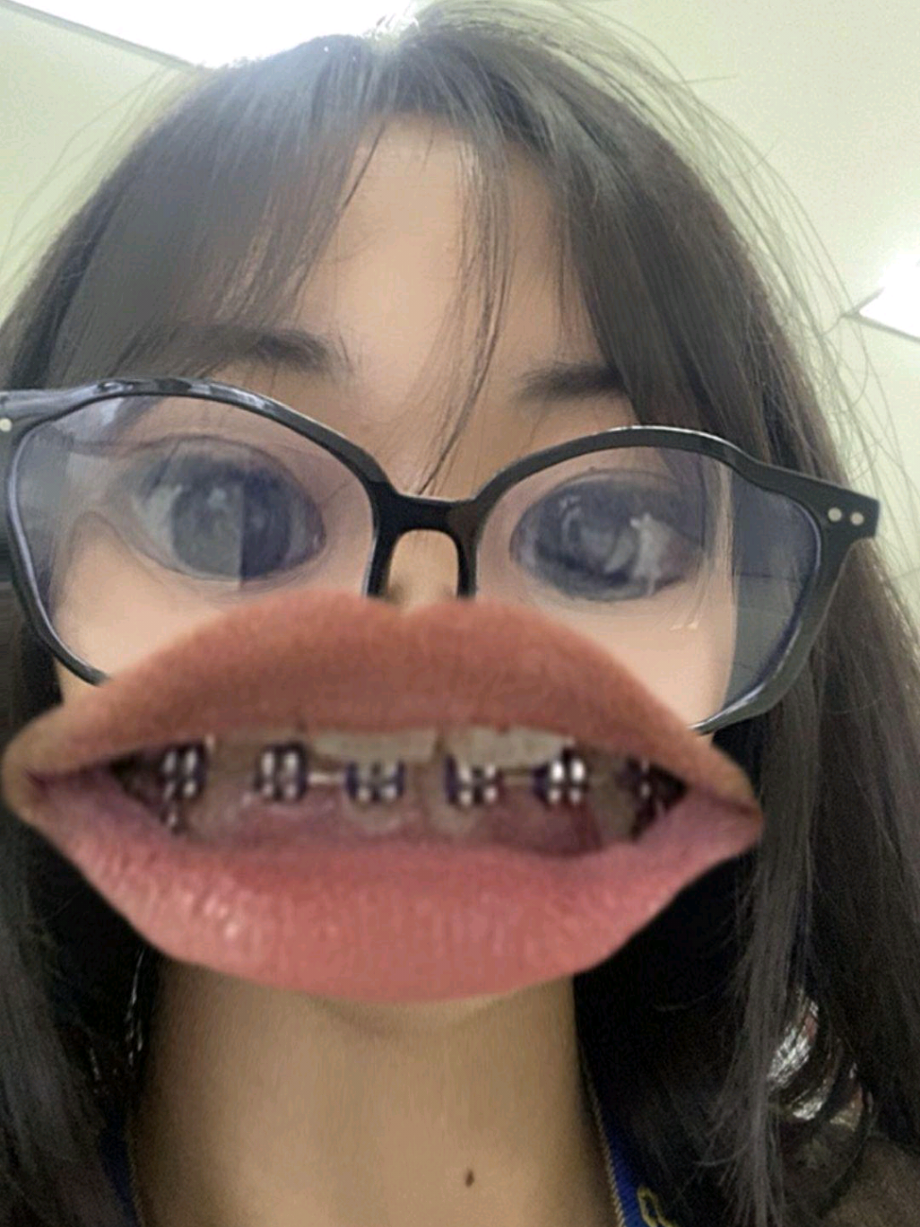 @lyn #viral #fyp #lyn #nori #4u 
