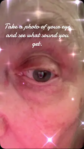 #EyePic #FYP