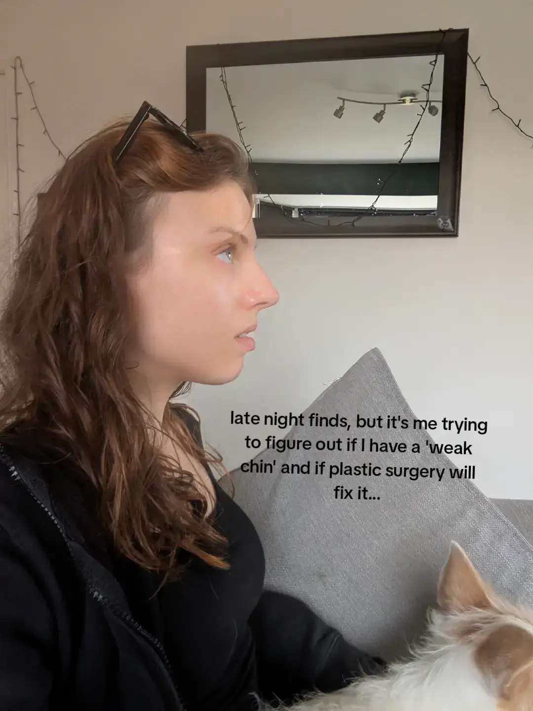 #weakchin #plasticsurgery #latenightfinds #sideprofile #insecurity 