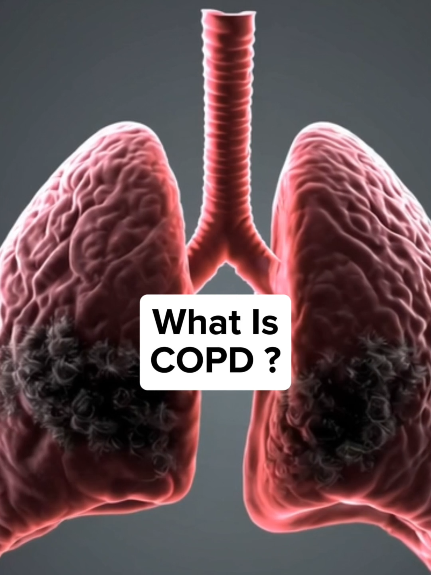 No supplement or product can cure COPD ❌ But protecting your lungs, avoiding irritants, and focusing on quality of life can make a real difference. Always watch out for scam products making false claims. 🫁 #COPD #LungHealth #PharmacistTips #BreatheBetter #RespiratoryHealth