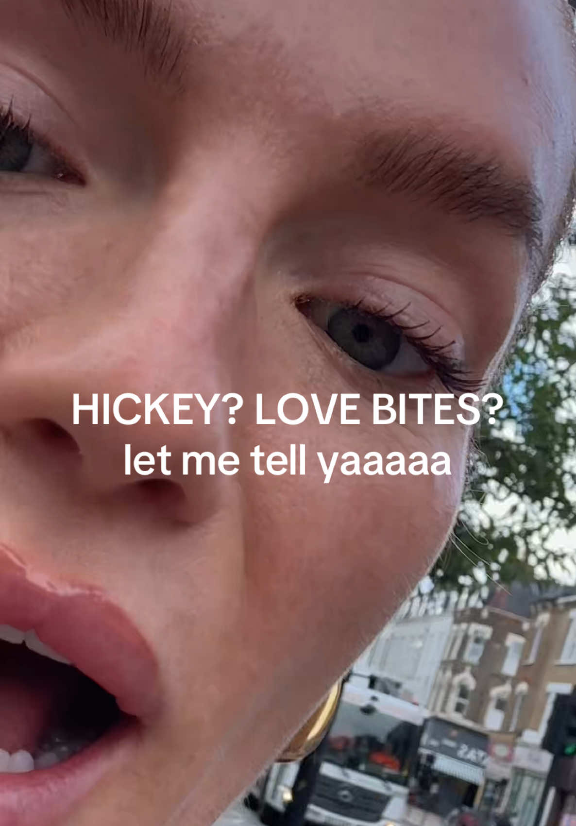 #stitch with @Pink Shade my necks been getting quite a lot of attention so here it is HICKEY GATE ANSWERED for y’all xxxx  #loveisblinduk 