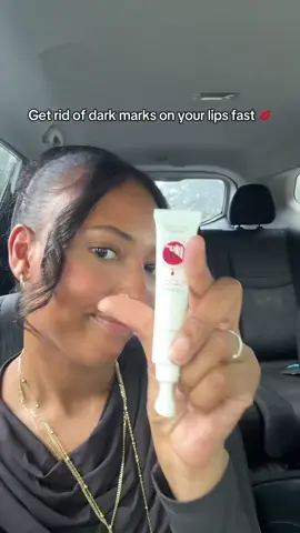 This serum is amazing I can't believe how quickly it worked #lipserum #hyperpigmentation #darkspots #lipcare #fy 