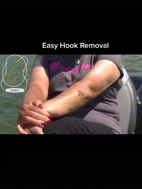 Easy hook removal! Painless...#fishing #fishingtipsandtricks #foryoupage #bassproshops #firstaid #fyp