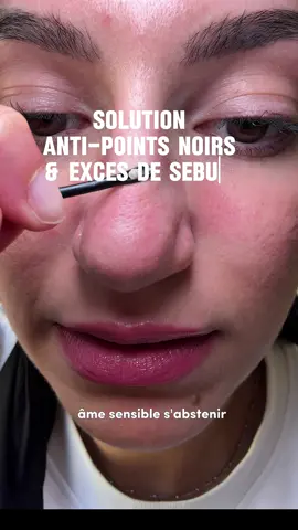 La solution anti-points noirs et excès de sébum : Le Ilso Natural Mild Clear Nose Pack en 2 étapes dissout l’excès de sébum, désincruste les pores et les affine grâce à sa feuille de biocellulose hypoallergénique 🌿  Enrichi en extrait de coque de châtaigne, eau d’hamamélis & panthénol, il purifie tout en réhydratant ta peau 💧 Disponible en pack de 5 ! Produit skincare coréen disponible sur SKINOREA.COM  #skinorea #kbeauty #pointsnoirs 