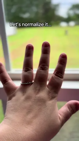 My fiance spent $1,500 on my engagement ring… why would I want to spend that much more on a wedding band?? My engagement ring is literally my favorite and holds so much value to me, so getting a cheaper band was the perfect fit for me! #weddingbandpairing #weddingbandset #weddingbandformen #weddingringstack #tiktokshopcreatorpicks 