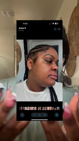 The way this bundle has changed my overall skin in the last two months 🤯 #skincareroutine #skincare #hyperpigmentation #koreanskincare #glassskin 
