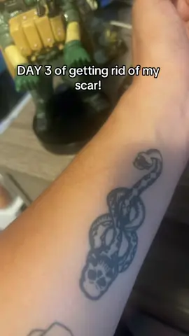 Day 3 of removing my scar. Could be cap.. #scarremoval #foryou #parati 
